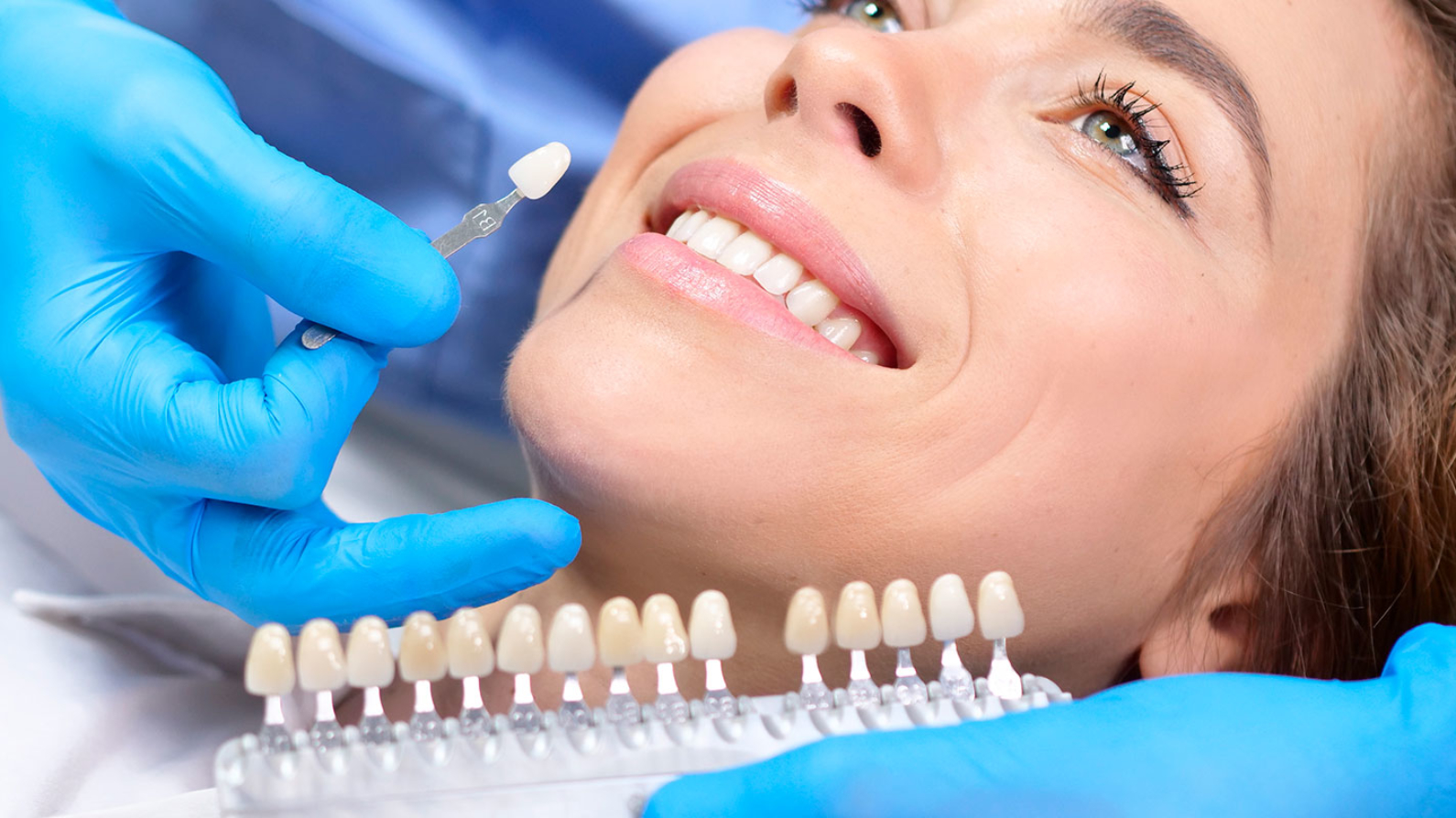 Blanqueamiento Dental Madrid Clínica Dental Dr. Hernán