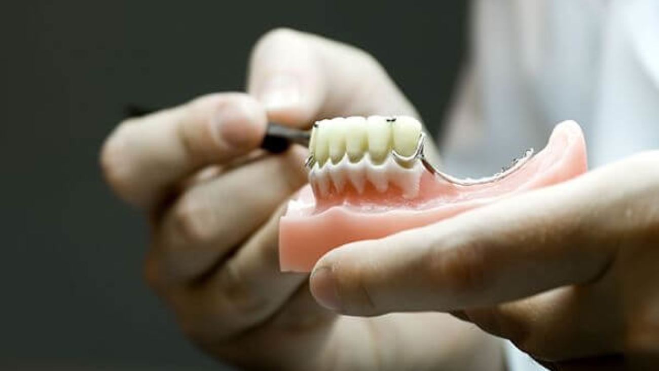 prótesis dental alternativa a implantes (1)